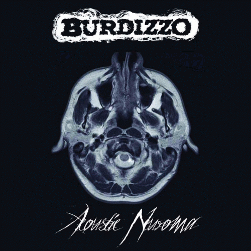 Burdizzo : Acoustic Neuroma